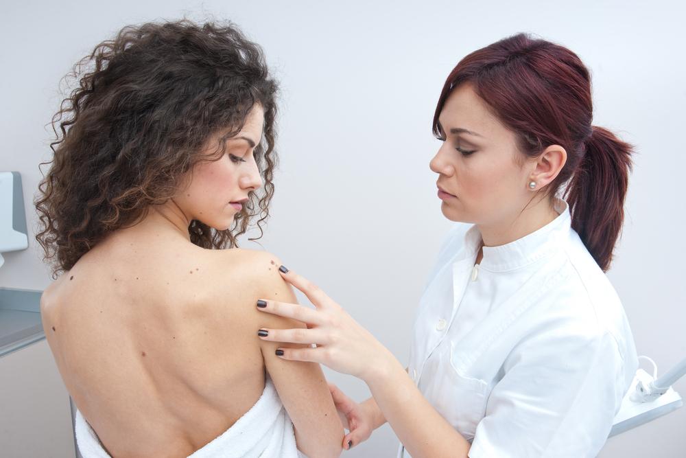 Treatment and prevention of melanoma