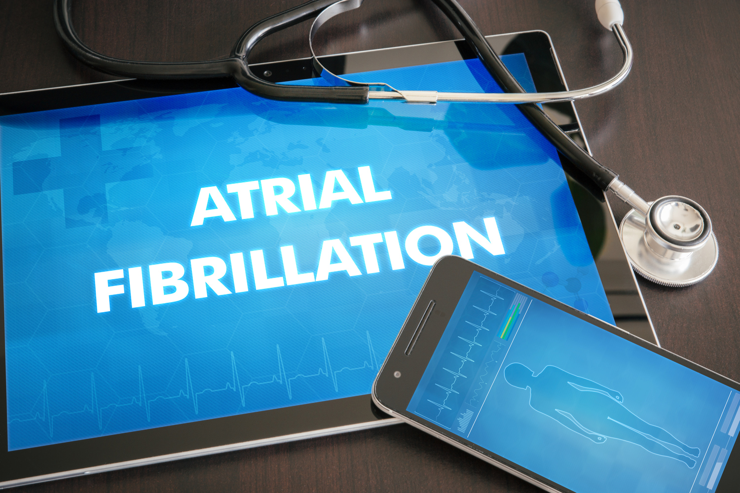 Top symptoms and causes of atrial fibrillation