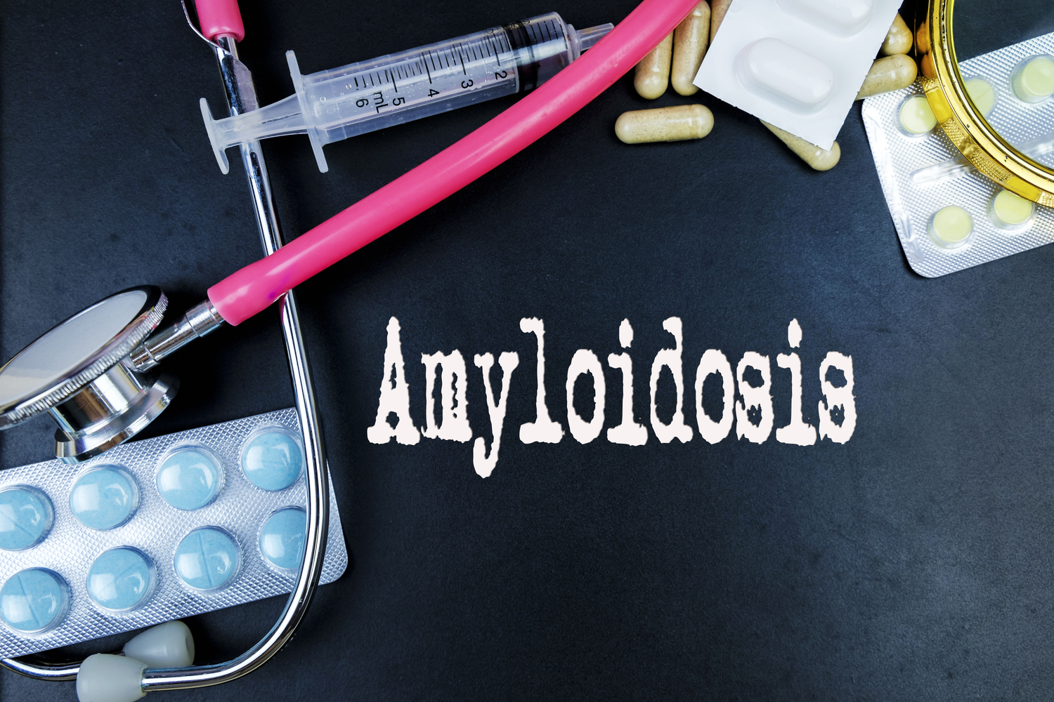 Common Types of Amyloidosis