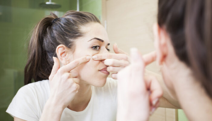 Common acne-treatment mistakes to avoid