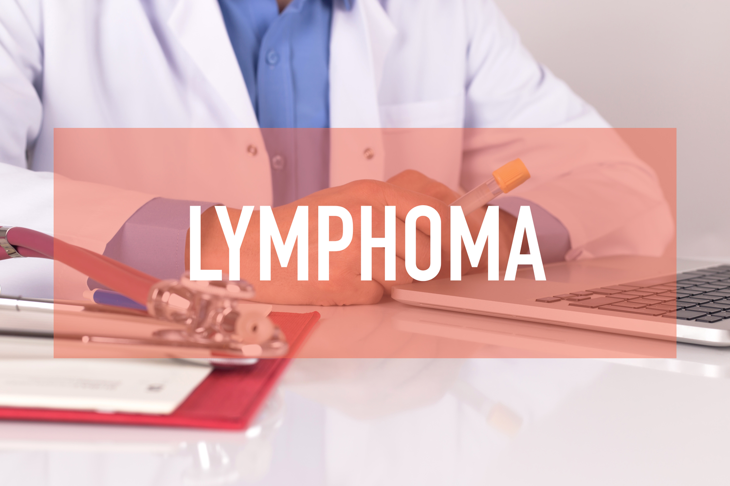 Stages and survival chances of non-Hodgkin’s lymphoma