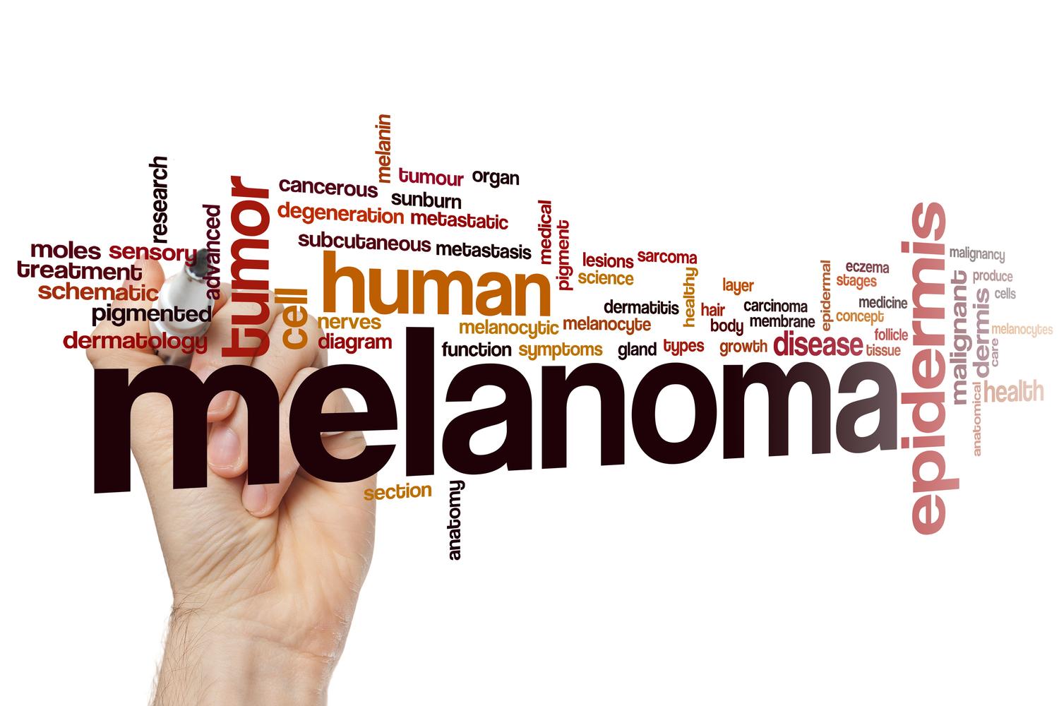 5 Early Warning Signs of Melanoma