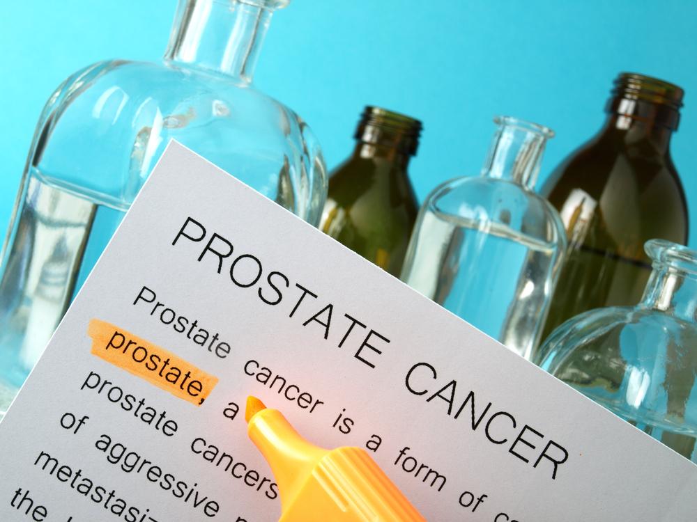 5 Visual Signs of Prostate Cancer