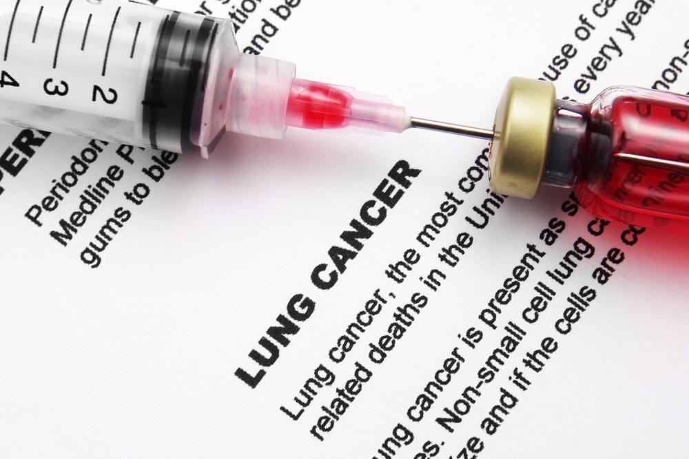Lesser Known Lung Cancer Symptoms