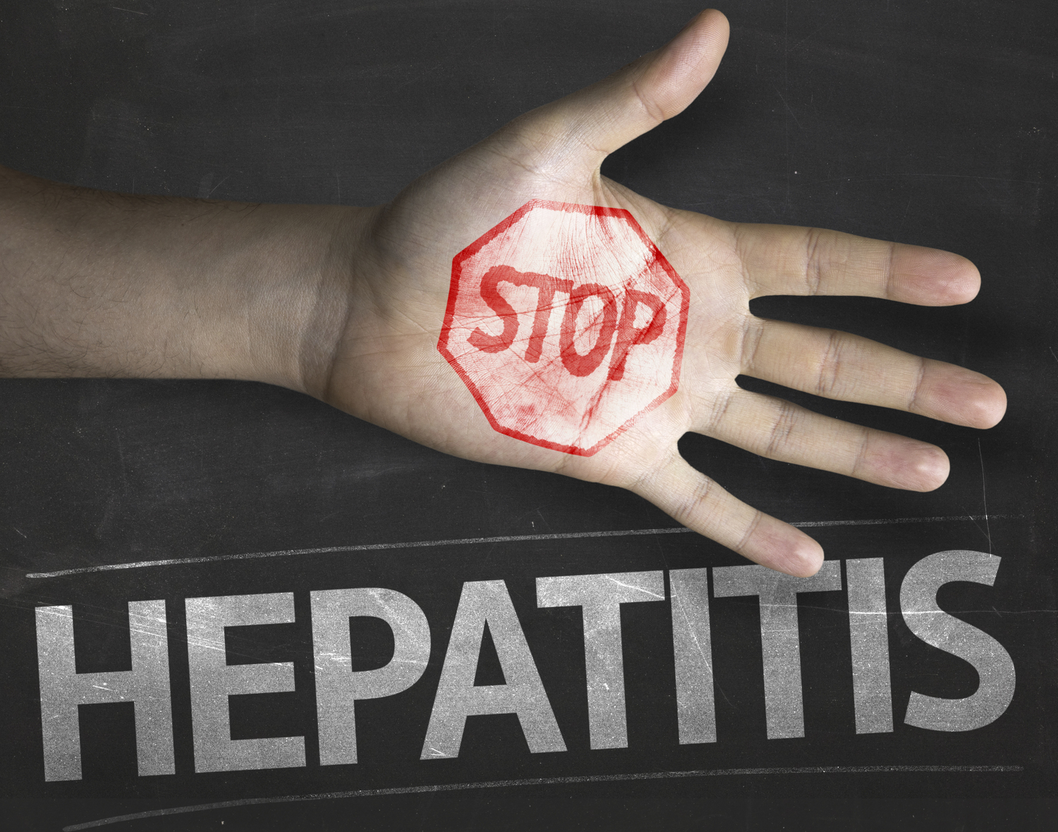 10 Common Early Symptoms of Hepatitis C